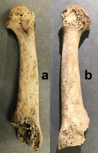 Vista lateral (a) i medial (b) del metatarsià segon de Calderón de la Barca