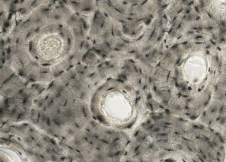 TFG Esther Solé Alarcon